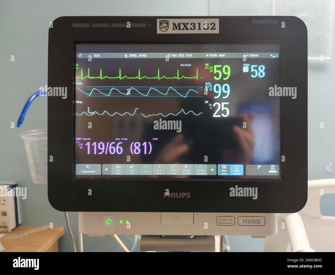 Moreno Valley, CA, USA - Nov 26, 2022: Modern health care portable monitor in hospital Stock Photo