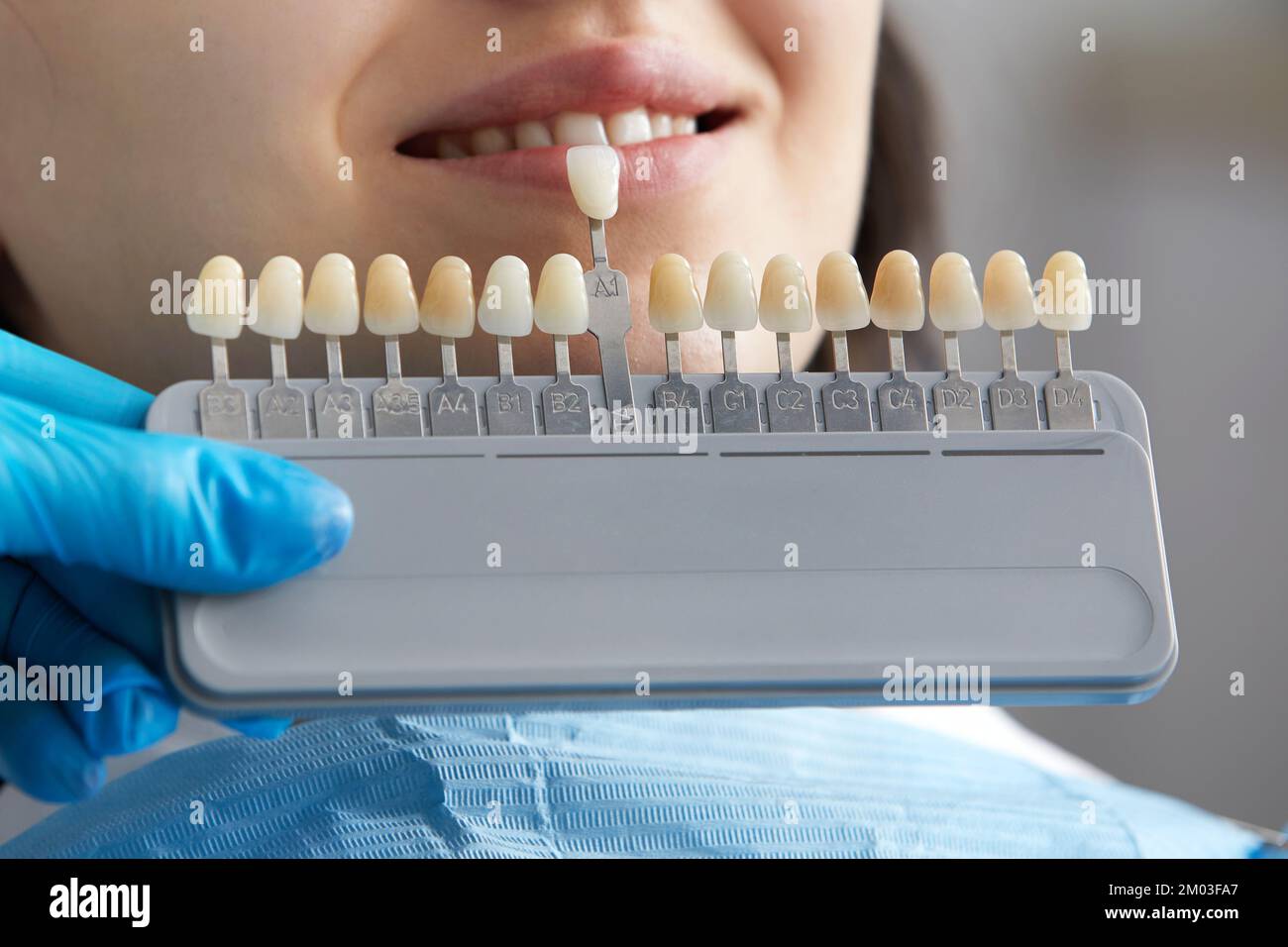 Dentist choosing color tone of tooth enamel for patient. Dentist