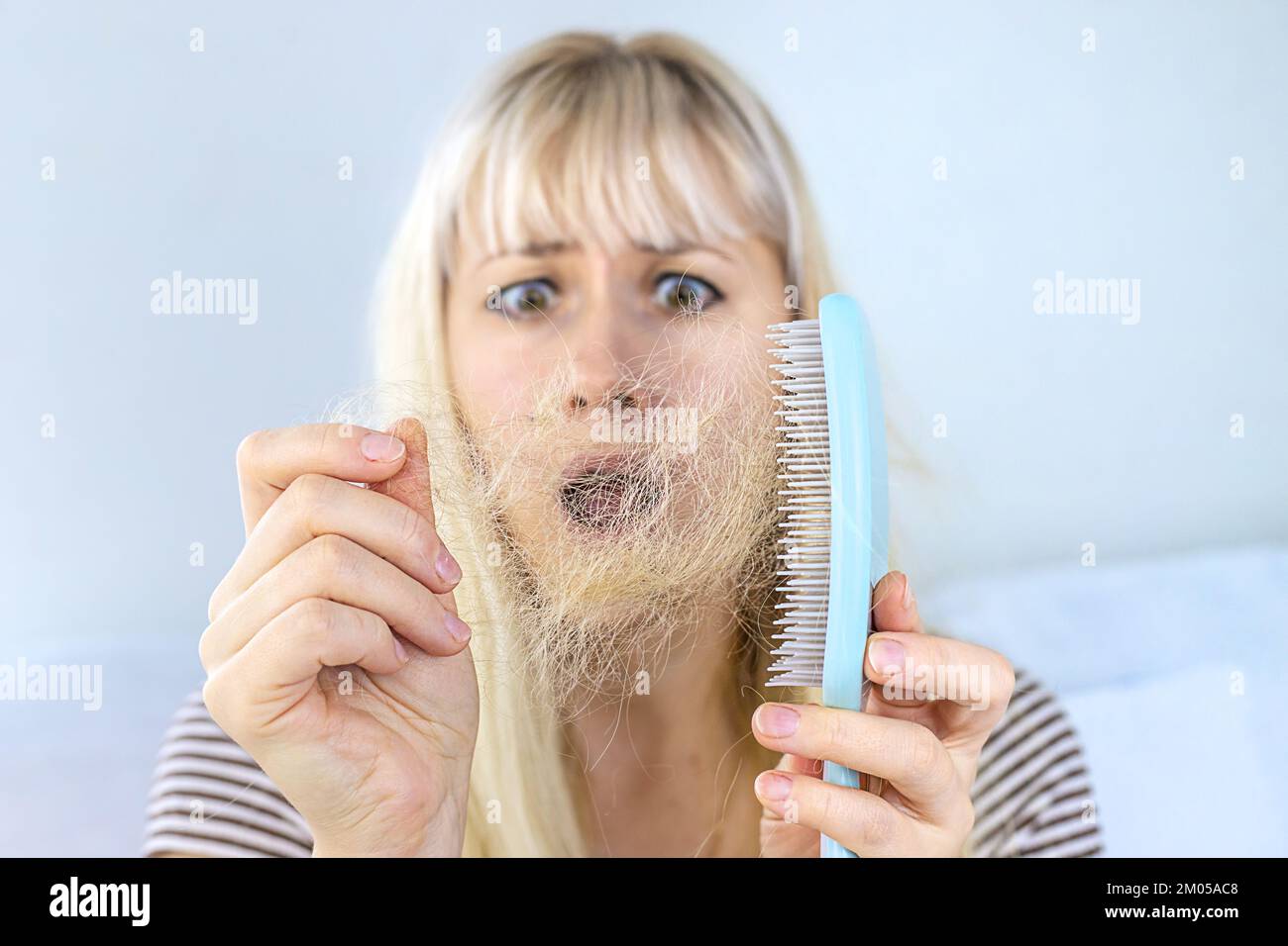 The woman hair is falling out. Selective focus. People Stock Photo Alamy