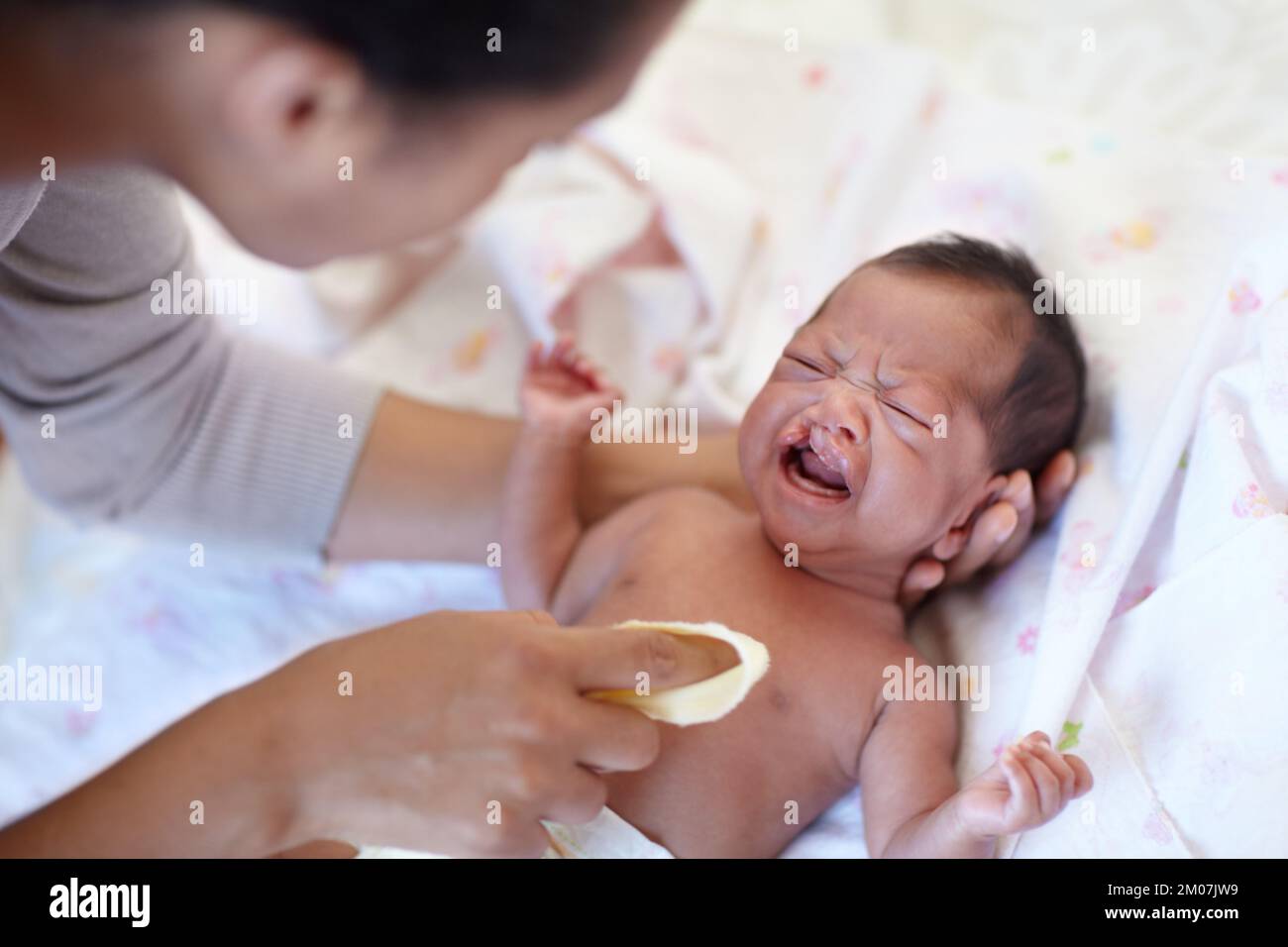 Nobody enjoys bathtime. A young mother cleaning her infant who has a cleft palate. Stock Photo