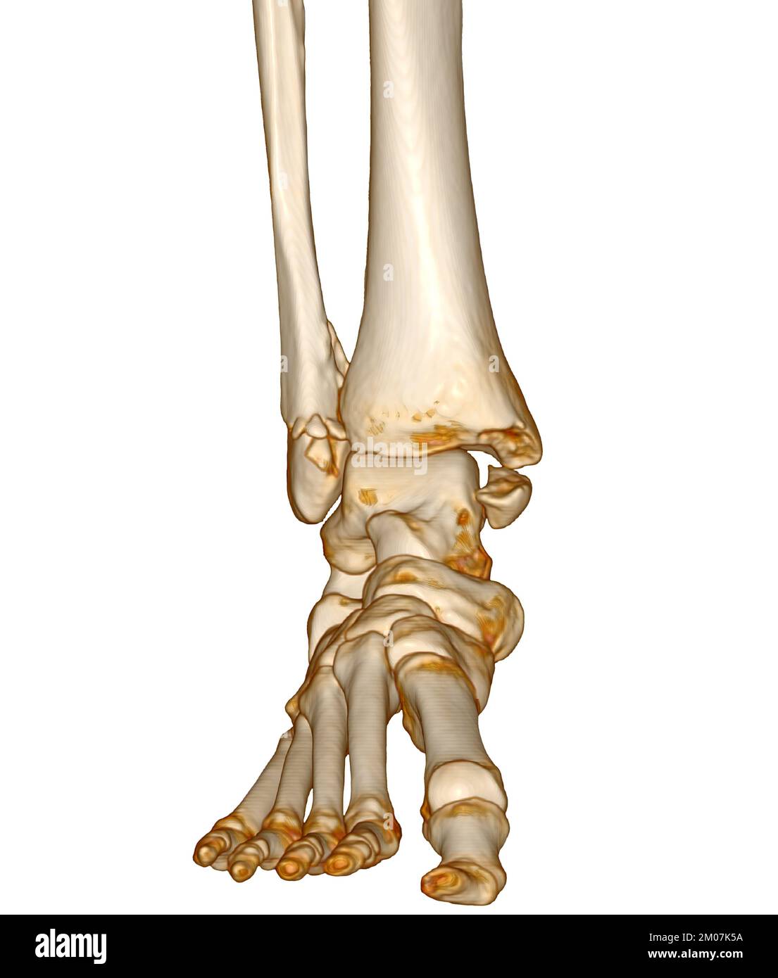 28,955 Ankle Joint Images, Stock Photos, 3D objects, & Vectors