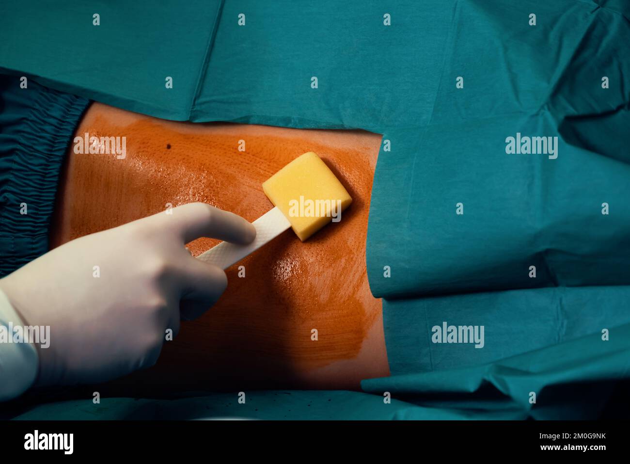 Doctor or surgeon apply betadine to the patient for anesthesia