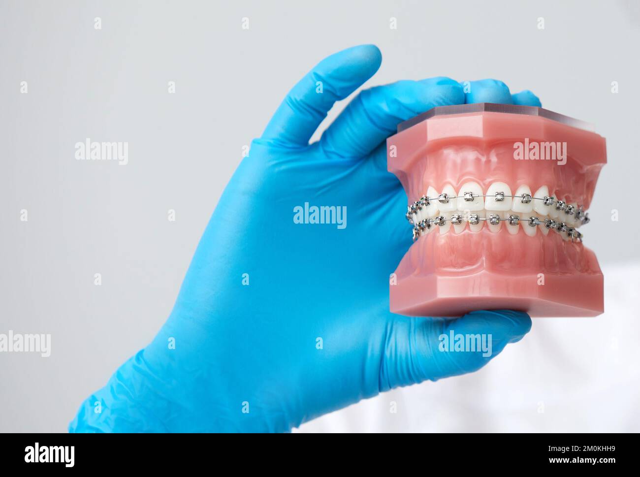 Orthodontist showing model of human jaw with wire braces attached with