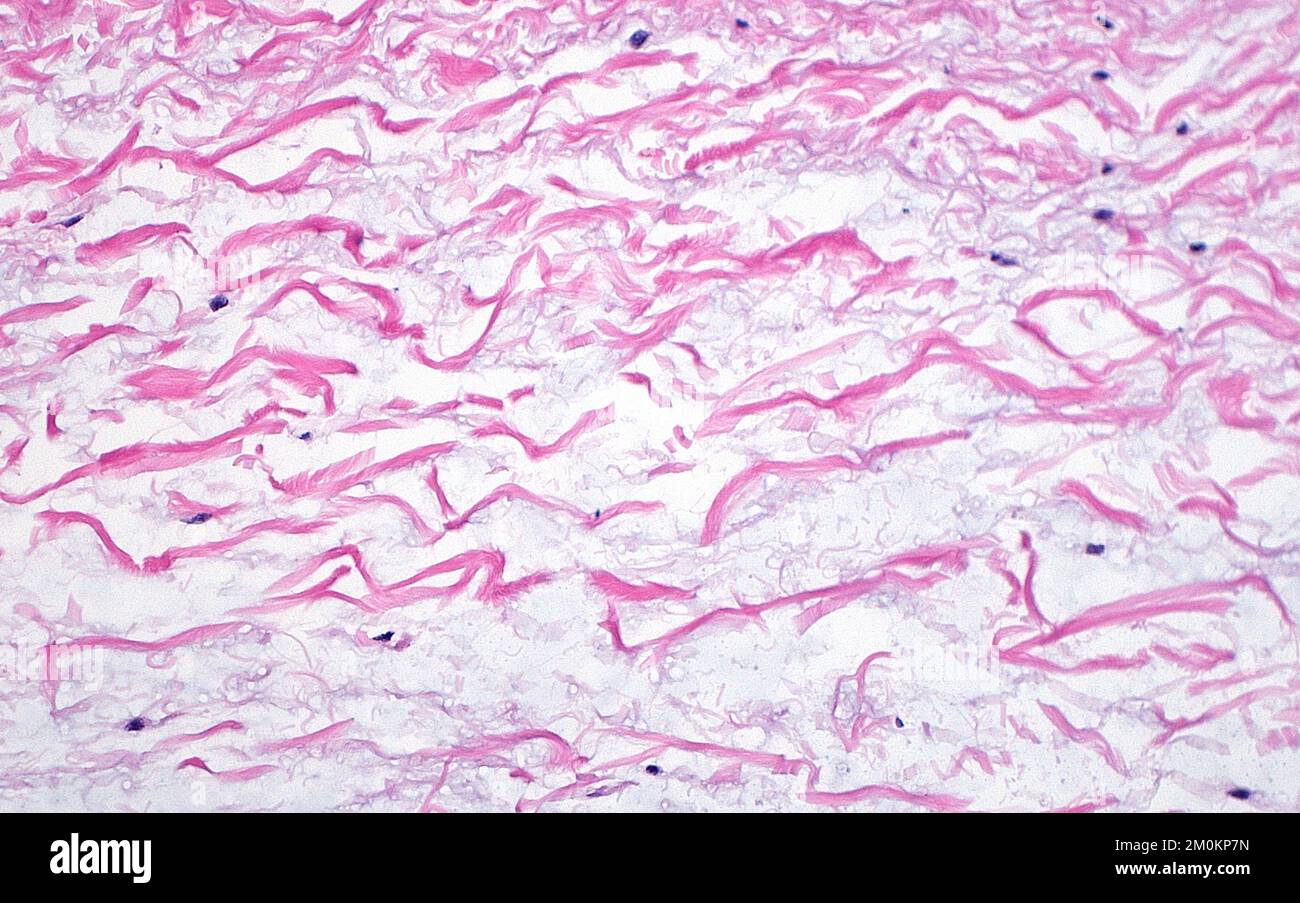 Collagen fibres, light micrograph Stock Photo - Alamy