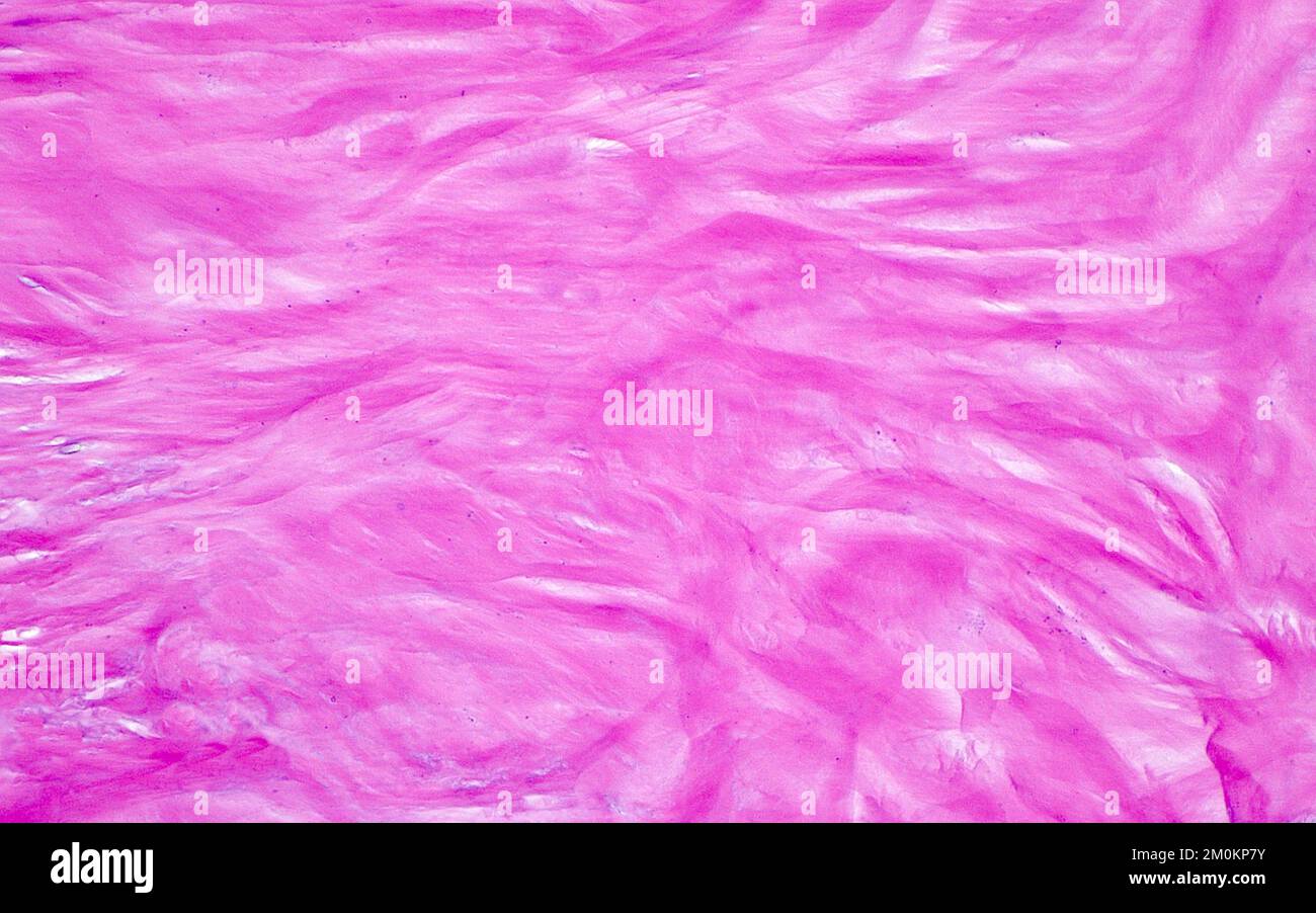 Collagen substance, light micrograph Stock Photo - Alamy