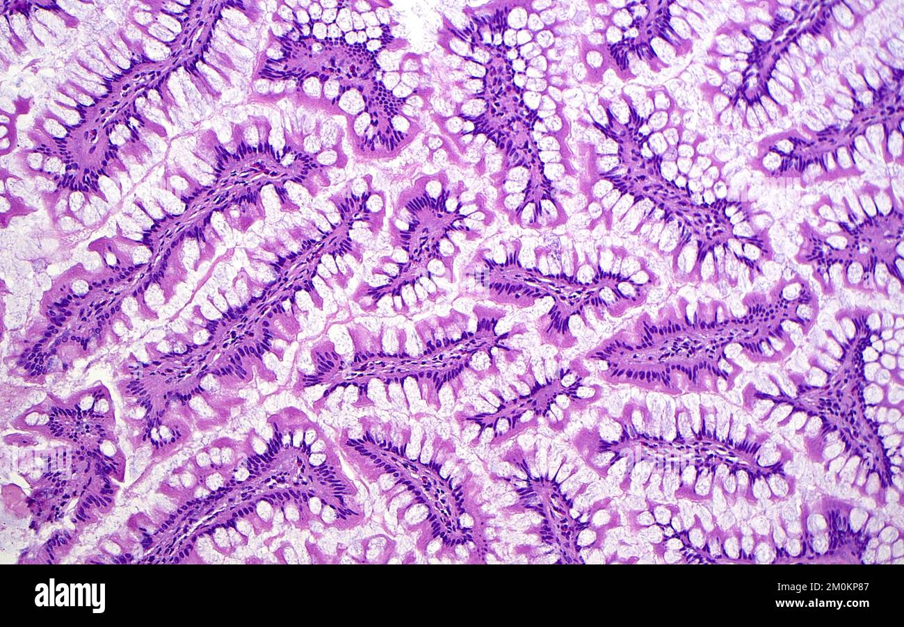 Small intestine, light micrograph Stock Photo - Alamy