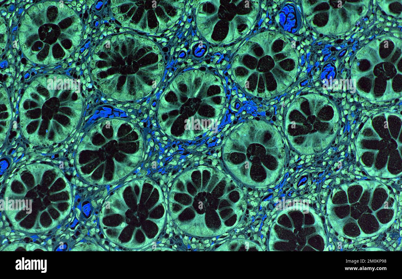 Colon Crypt Composition Colon epithelial crypt, light micrograph Stock Photo - Alamy