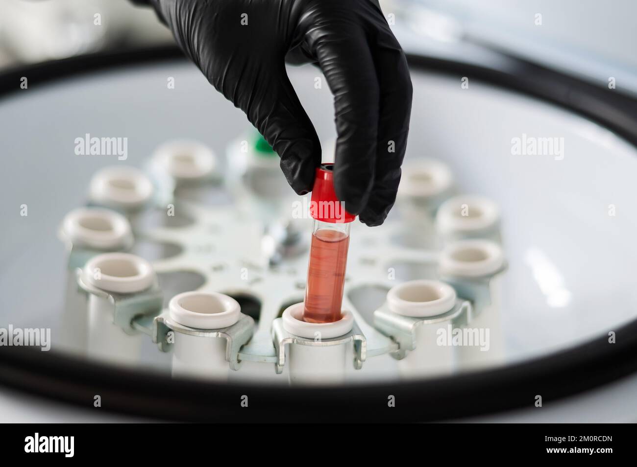The doctor takes out a test tube with blood plasma from the centrifuge.  Plasma lifting procedure for skin rejuvenation Stock Photo - Alamy, image size:1300x954