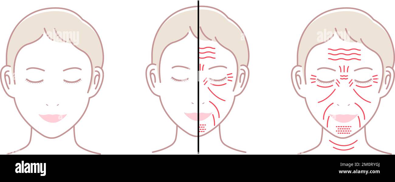 Facial wrinkles ( female face ) vector illustration set / no text Stock ...