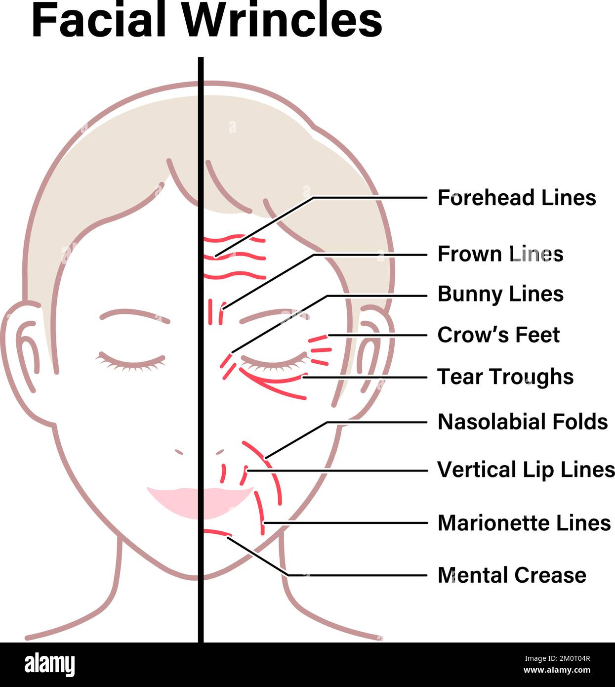 Facial wrinkles ( female face ) vector illustration Stock Vector