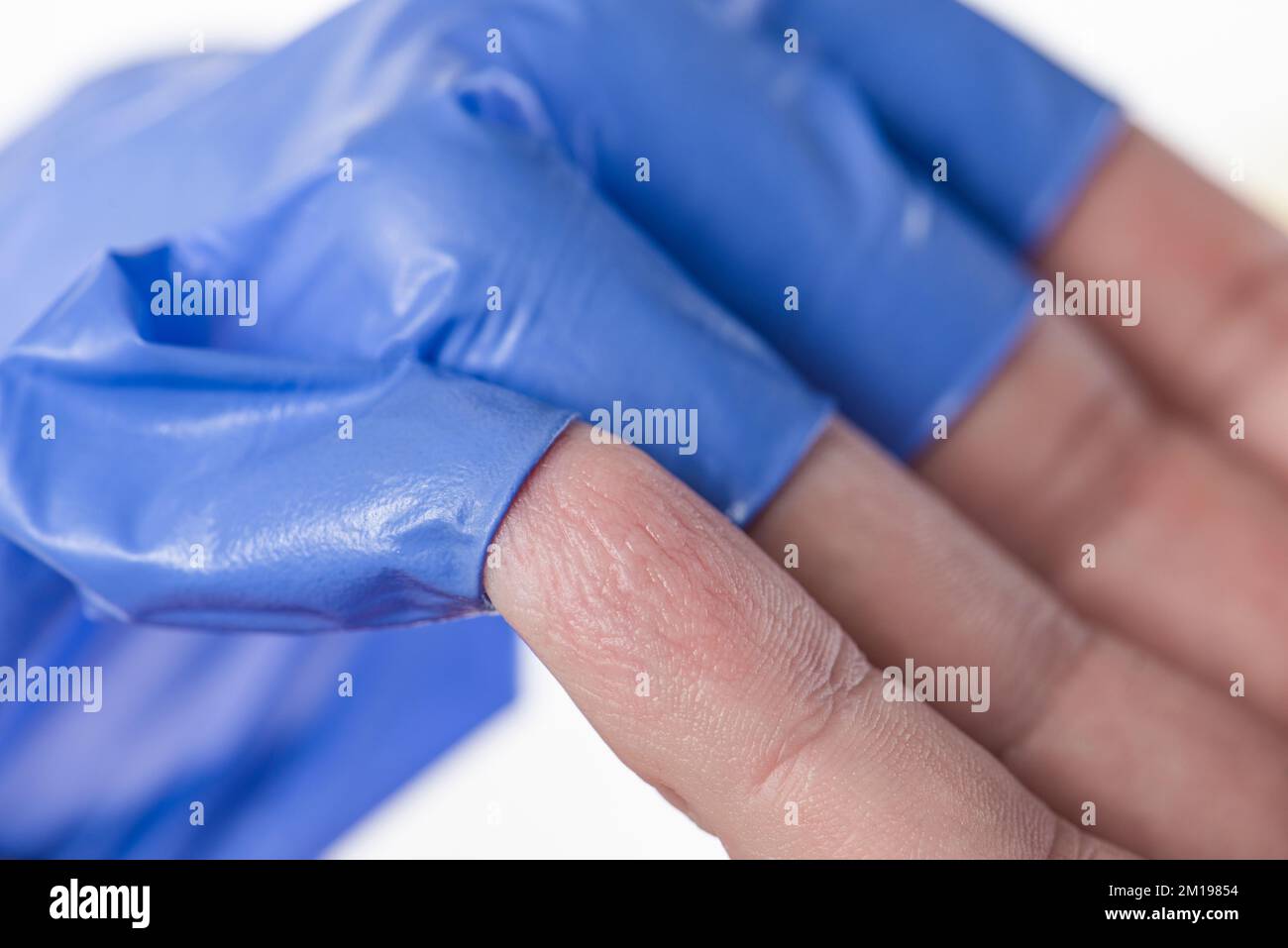 The doctor takes off his blue rubber gloves, the skin on his hands is wrinkled from moisture. Wrinkled fingers after wearing rubber gloves for a long Stock Photo
