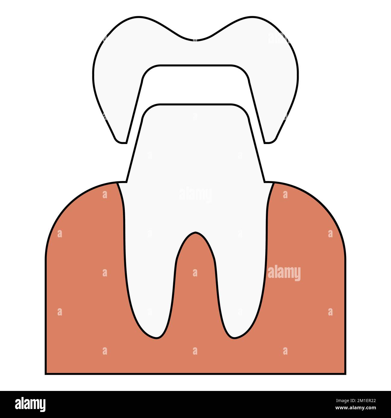 Crown dental tooth, white teeth, health medical, dentist crown model Stock Vector