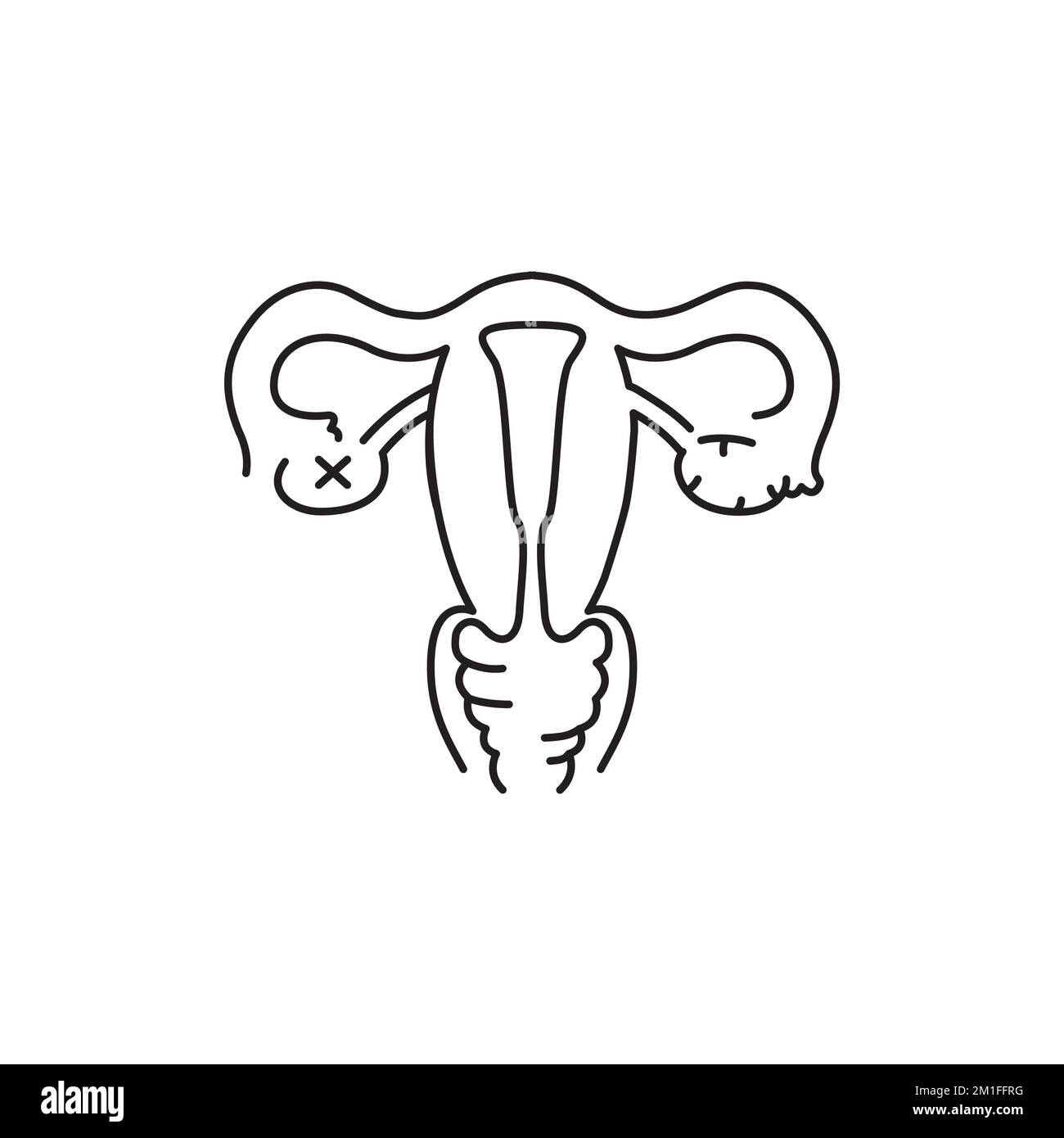 Uterine myoma color line icon. Gynecology problem. Pictogram for web ...
