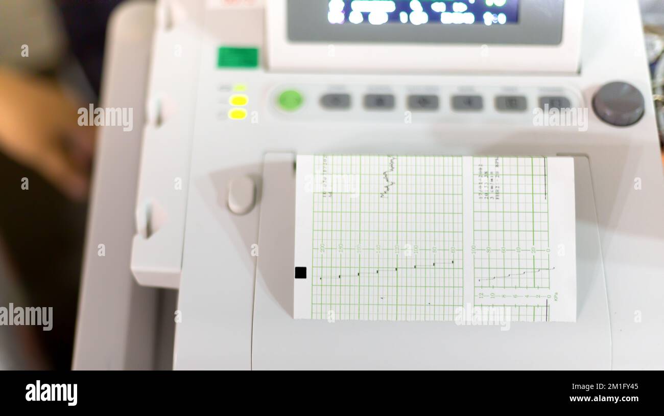 pregnant women prenatal baby heart rate chart check Stock Photo Alamy