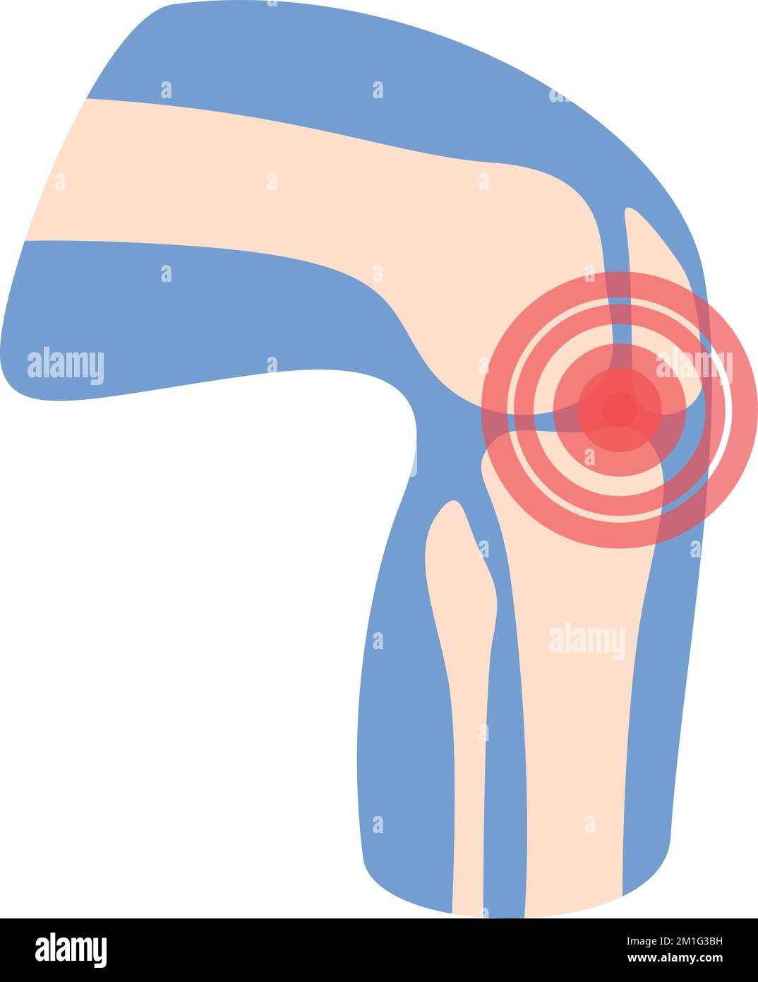 Knee pain icon cartoon vector. Arthritis joint. Treatment articulation Stock Vector