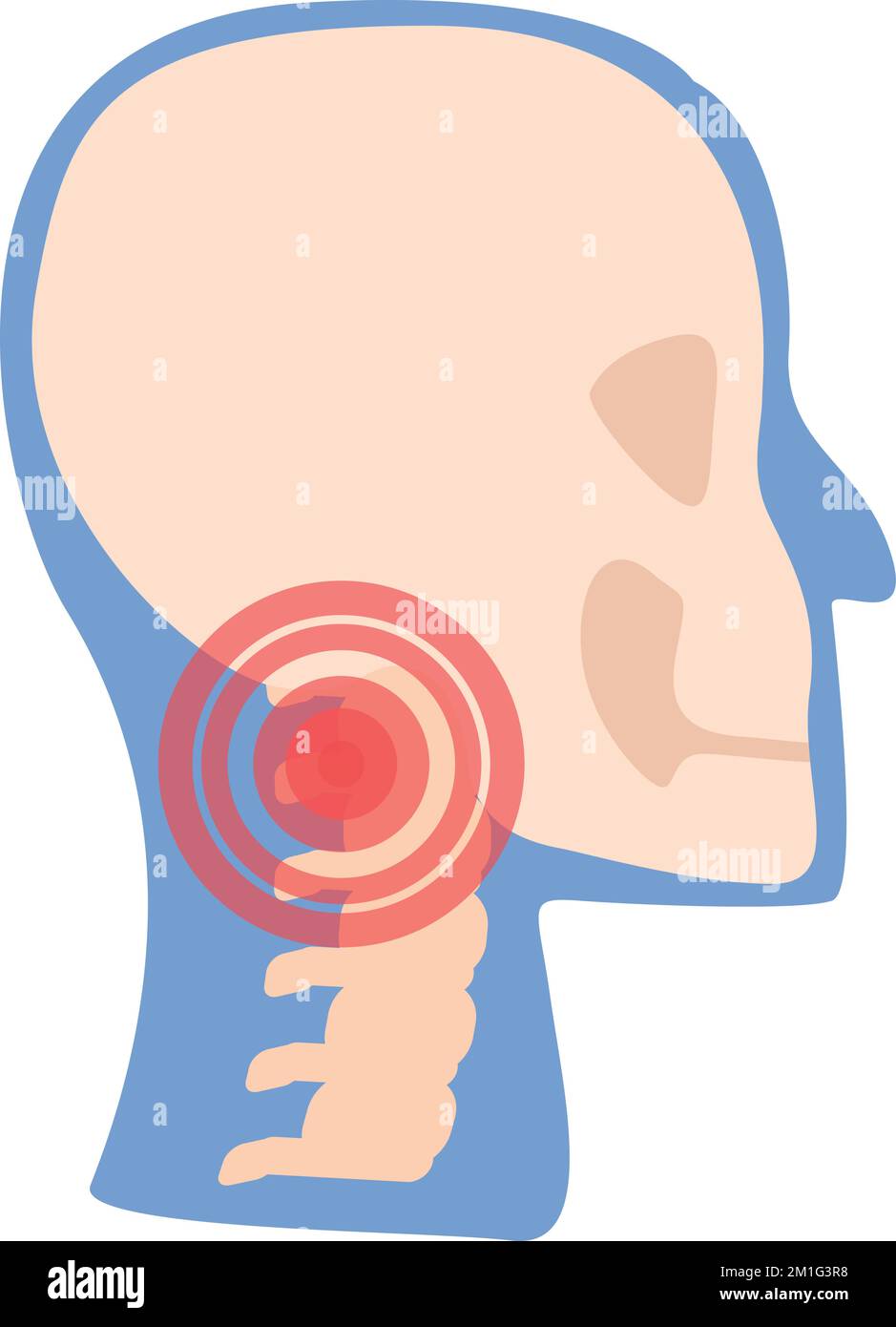 Head spine pain icon cartoon vector. Arthritis joint. Medical treatment Stock Vector