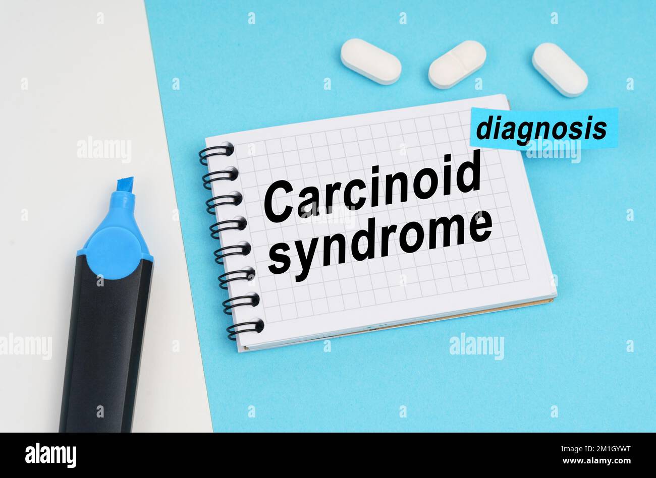 Medicine and health concept. On a white and blue surface are pills, a marker and a notebook with the inscription - Carcinoid syndrome, a sticker with Stock Photo