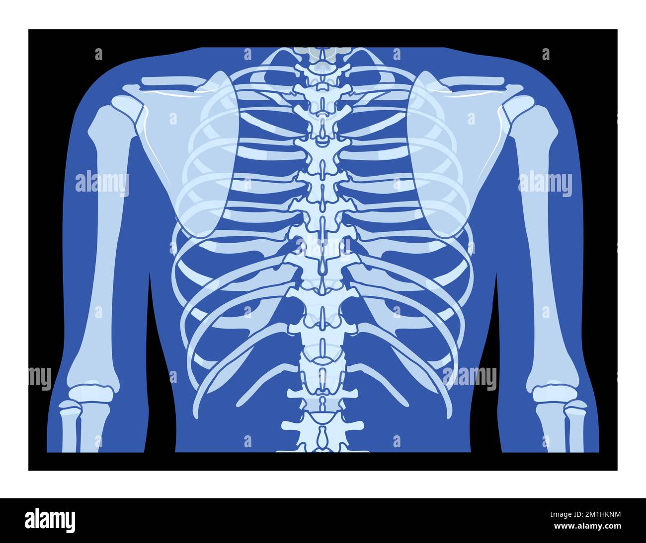X-Ray rib cage and hands Skeleton Human body Bones adult people roentgen back view. 3D realistic flat blue color concept Vector illustration of medical anatomy isolated on black background Stock Vector