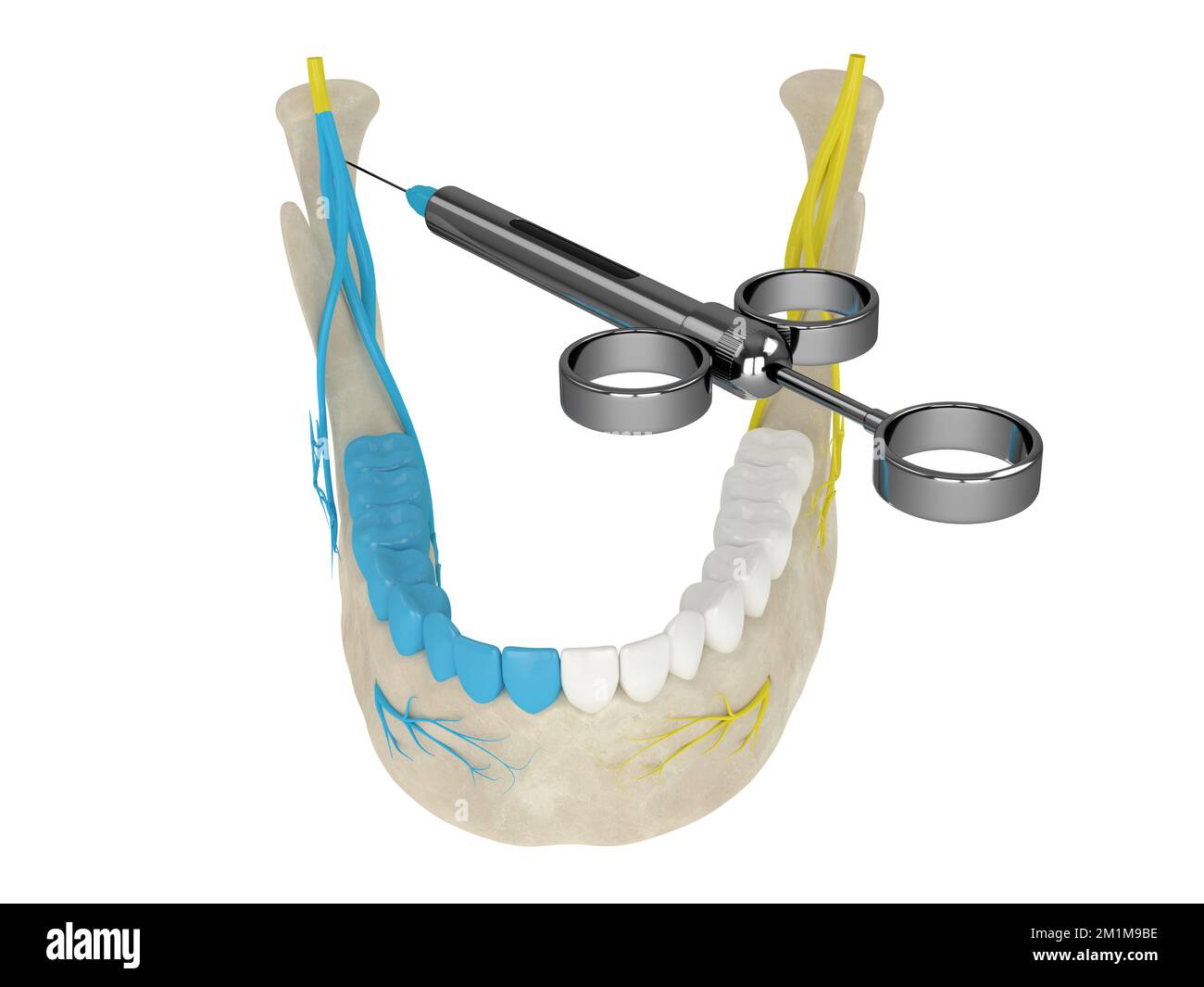 3d render of mandibular arch with gowgates nerve block. Types of dental anesthesia concept