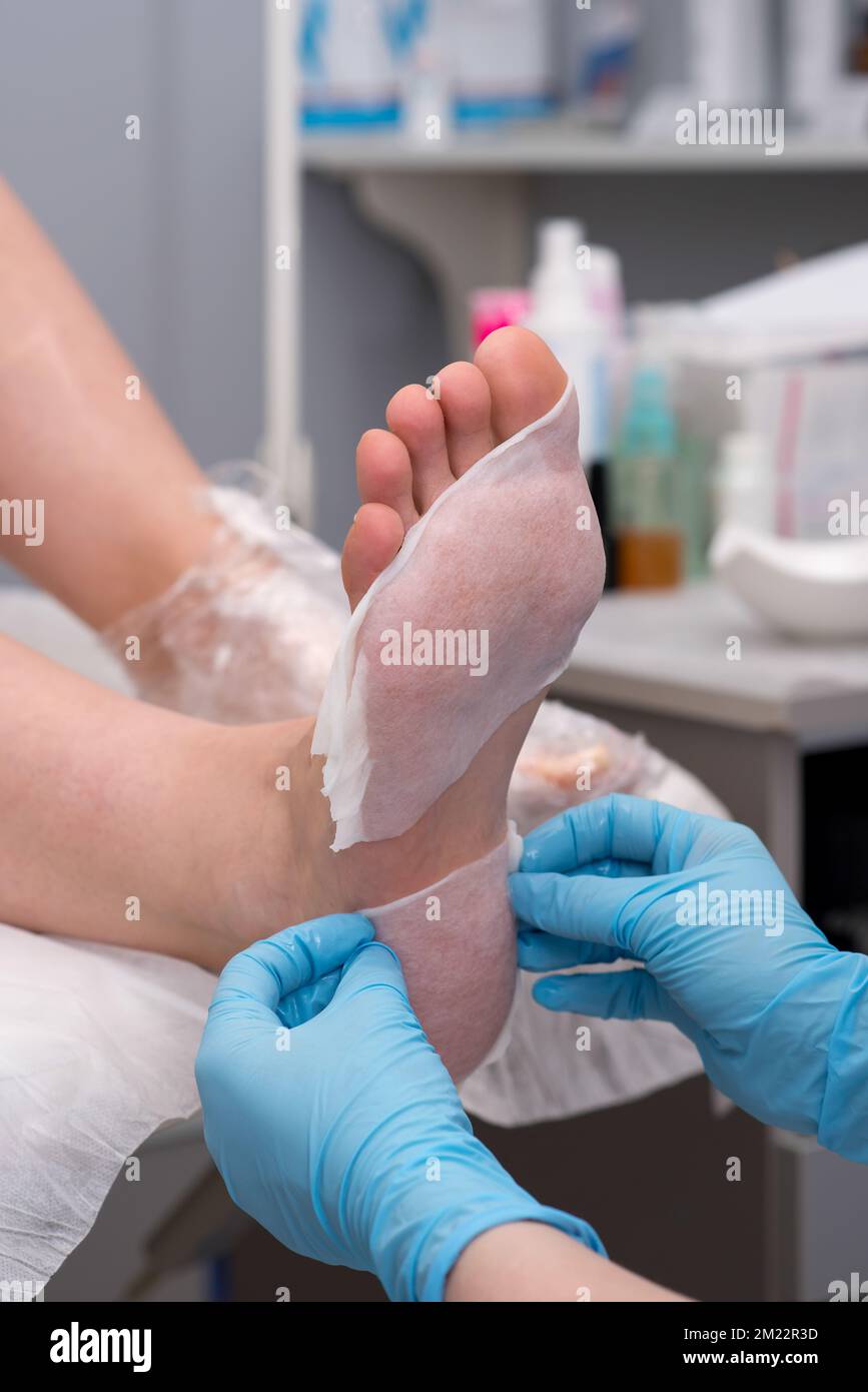 Pedicure Dead Skin Remover Feet Care Woman Stock Image - Image of person,  beautician: 61775201