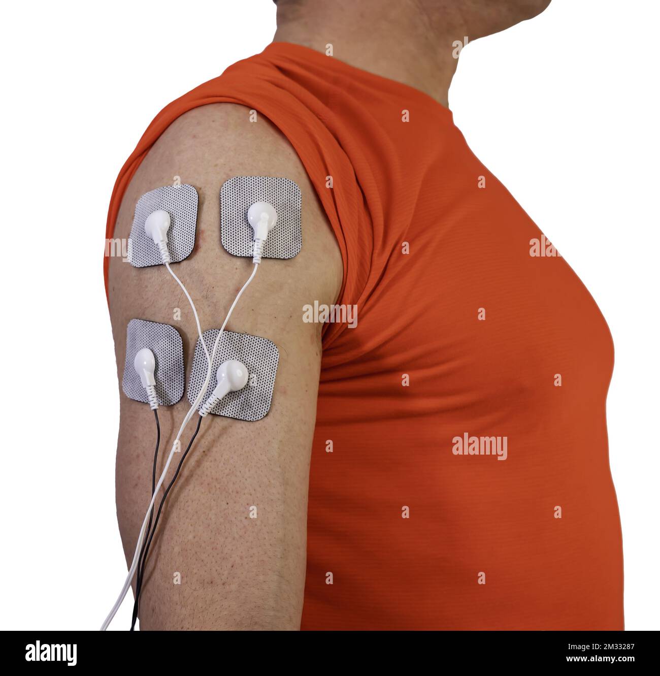 A person with electrodes on the arm is an effective way to rehabilitate, massage or stimulate muscles Stock Photo