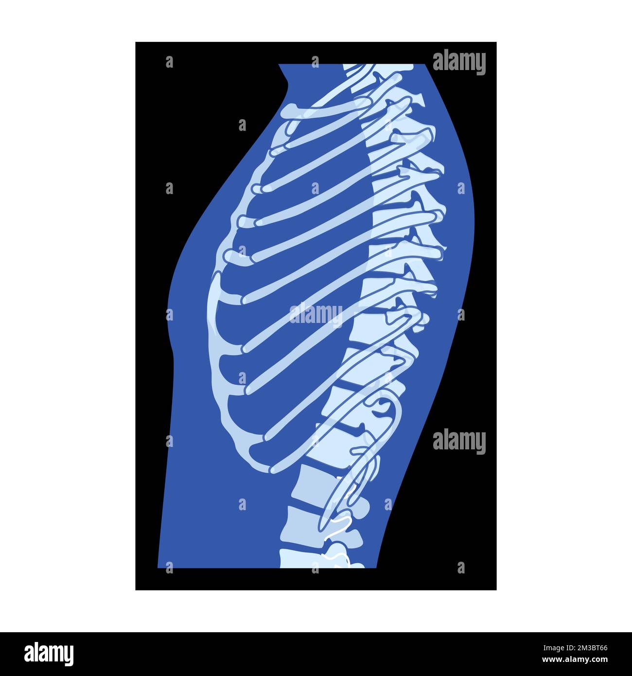 X-Ray Rib cage Skeleton Human body - chest, vertebra, Bones adult people roentgen side view. 3D realistic flat blue color concept Vector illustration of medical anatomy isolated on black background Stock Vector