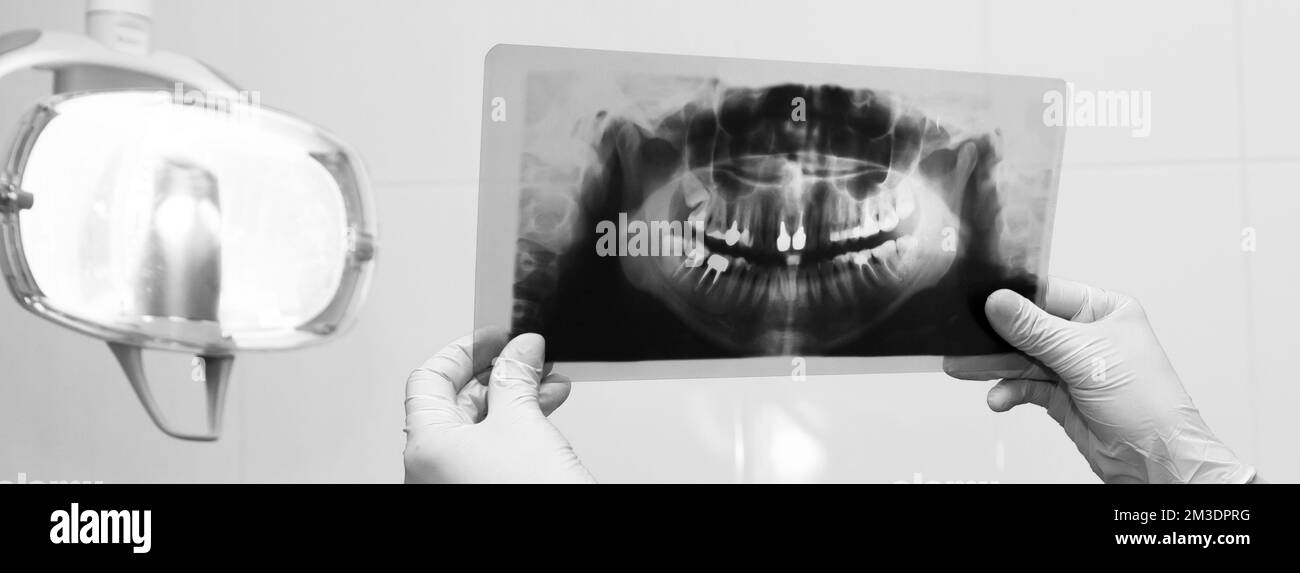 Dentistry x ray image of female jaw and teeth Black and White Stock ...