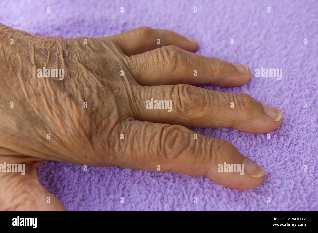 A wrinkled hand with arthritis on a purple background. inflammation hand in the elderly Stock