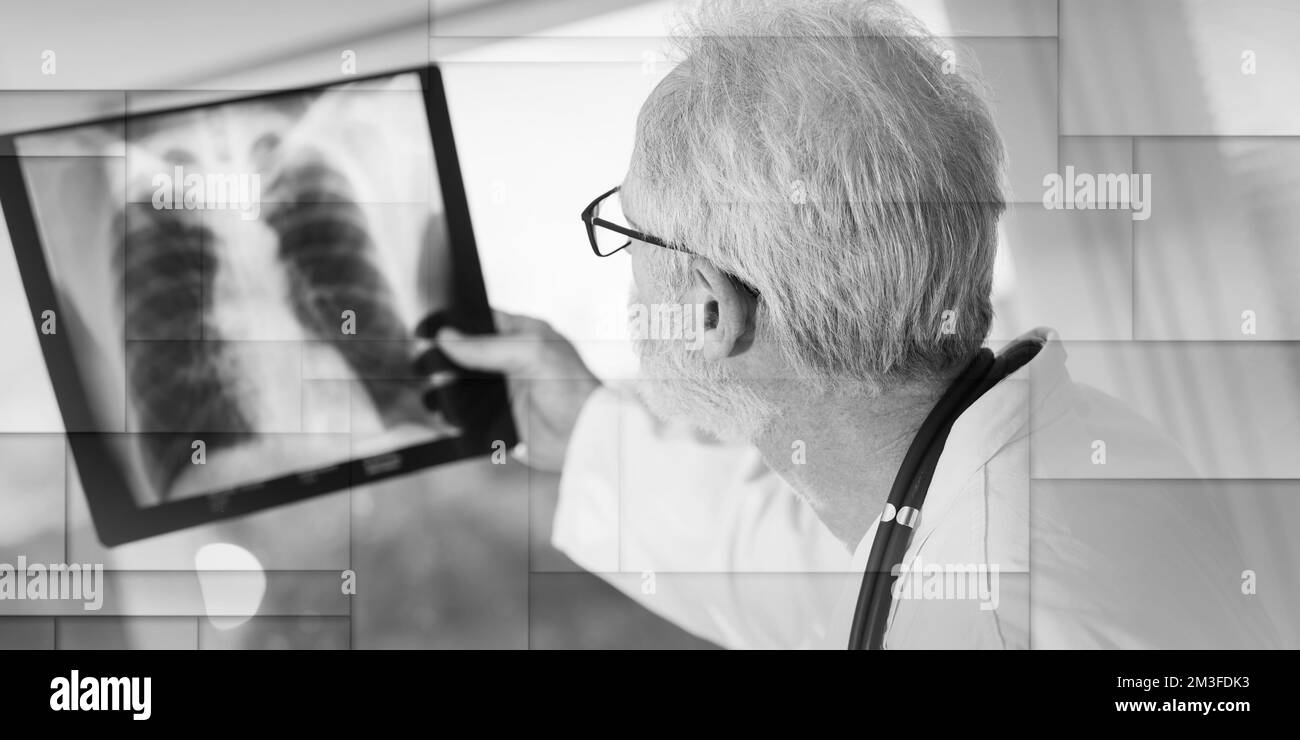 Doctor looking ray radiography Black and White Stock Photos & Images ...