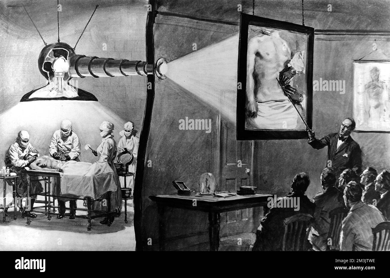 An invention by Mr Herbert A. Silver enabling medical students to watch