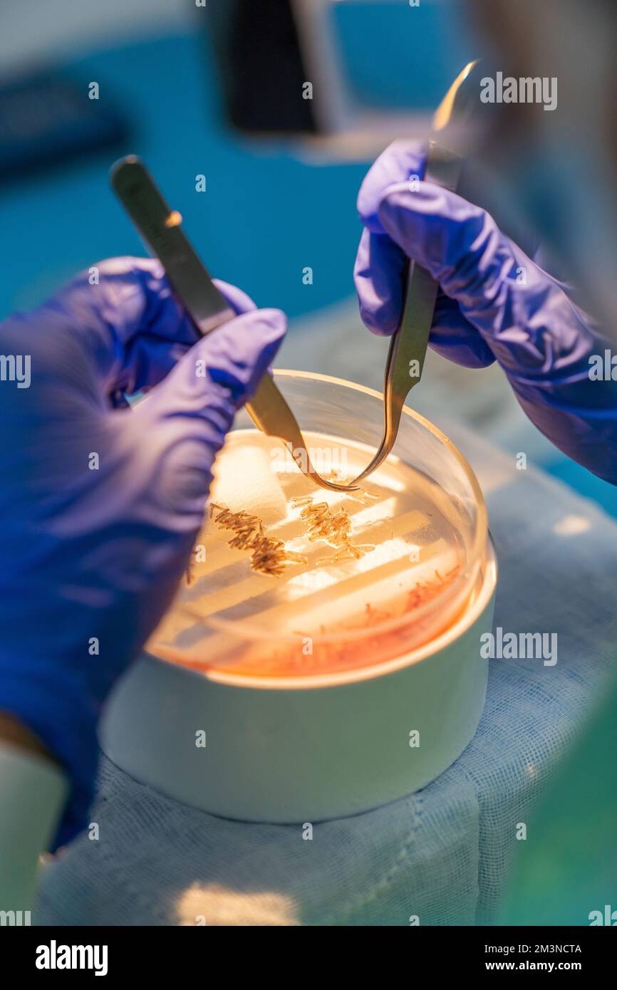 Hair follicle microscope hires stock photography and images Alamy