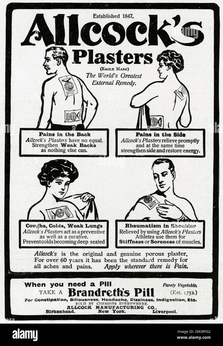 Allcock's Porous Plasters for pain relief, rheumatism in shoulders, stiffness or soreness of muscles, prevent coughs, colds, weak lungs and strengthen weak backs and sides and restore energy.  1915 Stock Photo