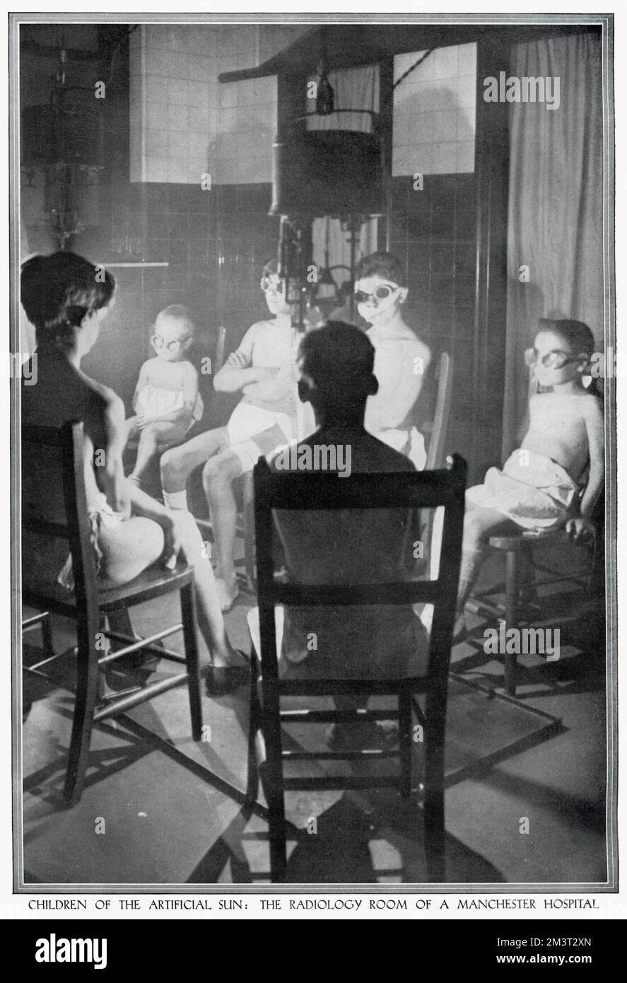 A group of children wearing protective goggles are undergoing treatment of radiation therapy, using ultra violet light at Manchester Hospital. Stock Photo