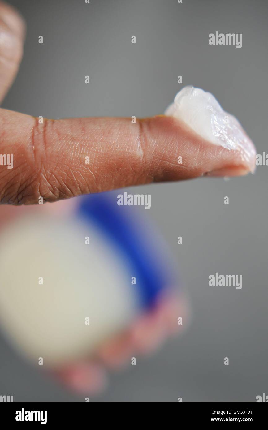 Close up of man hand using petroleum jelly  Stock Photo