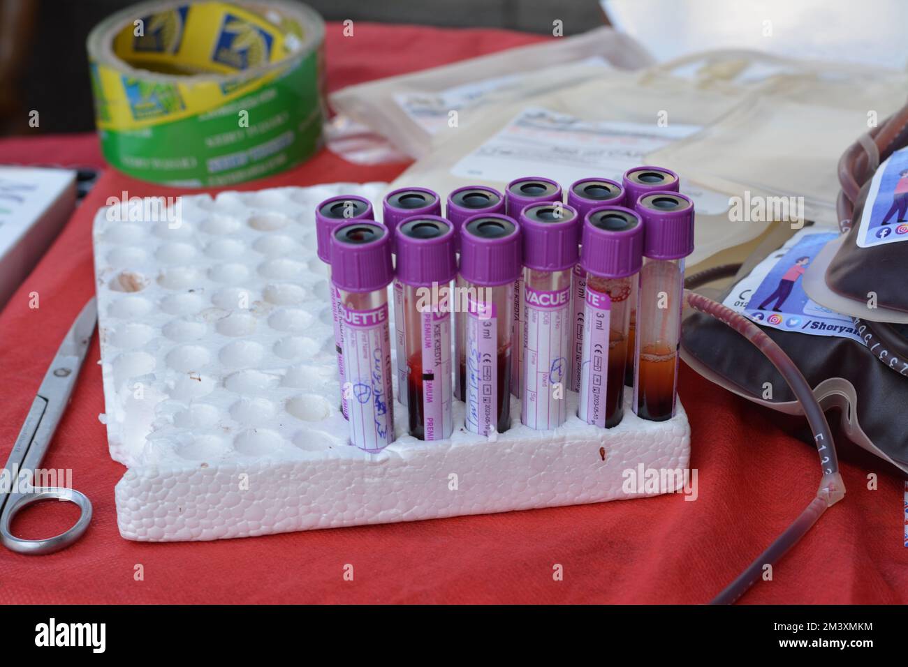 Cairo, Egypt, December 15 2022 blood samples in tubes collected from