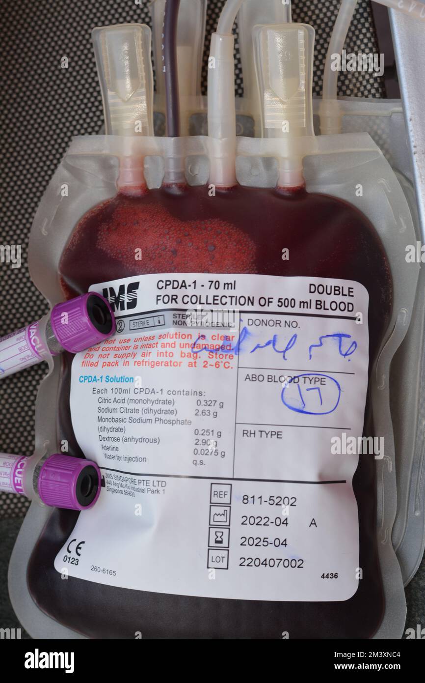 Cairo, Egypt, December 15 2022 blood bag and blood samples collected