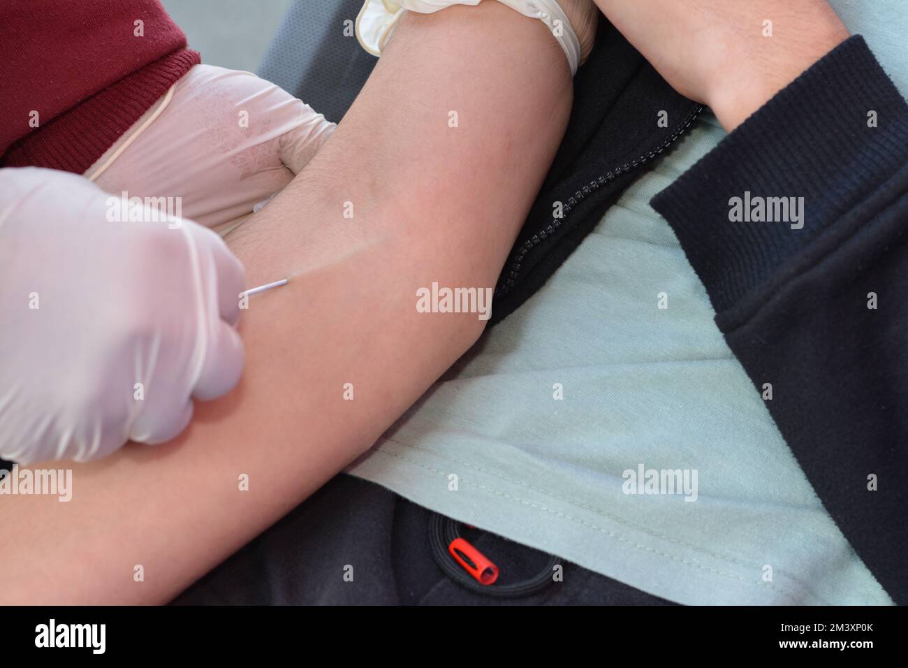 Blood donation, a blood donor volunteer with and intravenous line collecting a blood bag for charity and children with thalassemia and other diseases, Stock Photo