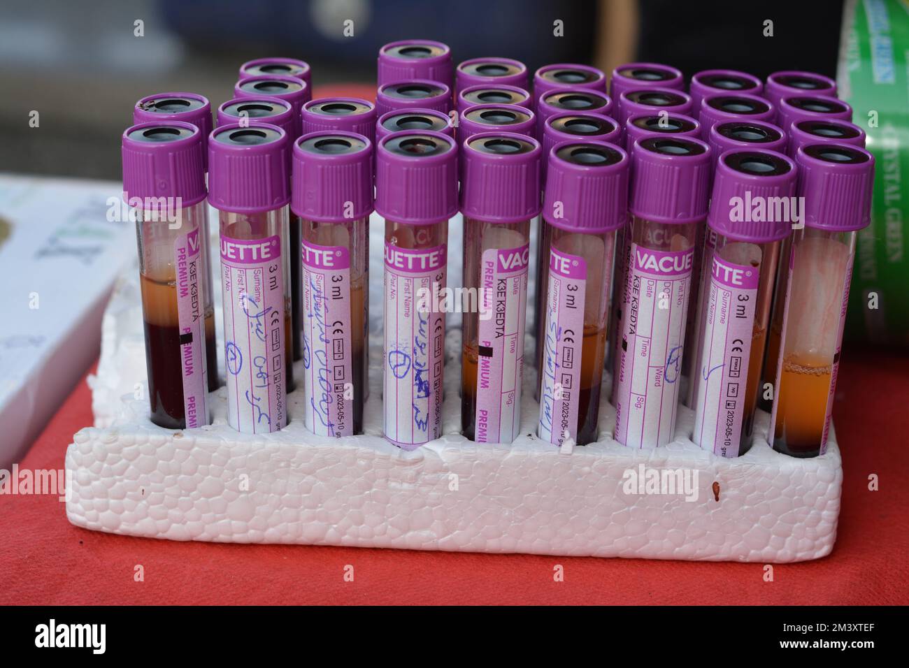 Cairo, Egypt, December 15 2022: blood samples in tubes collected from ...