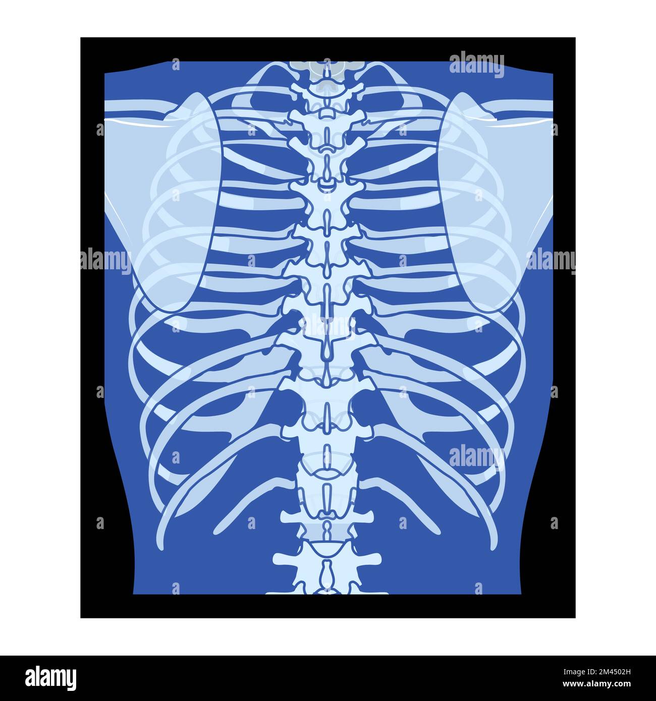 X-Ray Rib cage Skeleton Human body - chest, vertebra, Bones adult people roentgen back view. 3D realistic flat blue color concept Vector illustration of medical anatomy isolated on black background Stock Vector