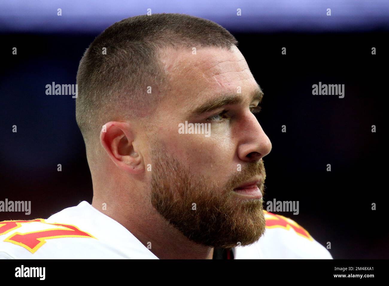 What Station Is Showing The Kansas City Chiefs Game Today What Station Is Showing The Kansas City Chiefs Game Today