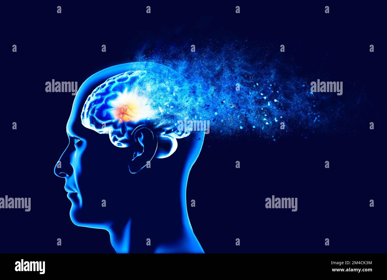 Memory lapses, forgetting things, degenerative disease. Brain problems. Parkinson and alzheimer desease. Mental health. Stroke, synapses and neurnons Stock Photo