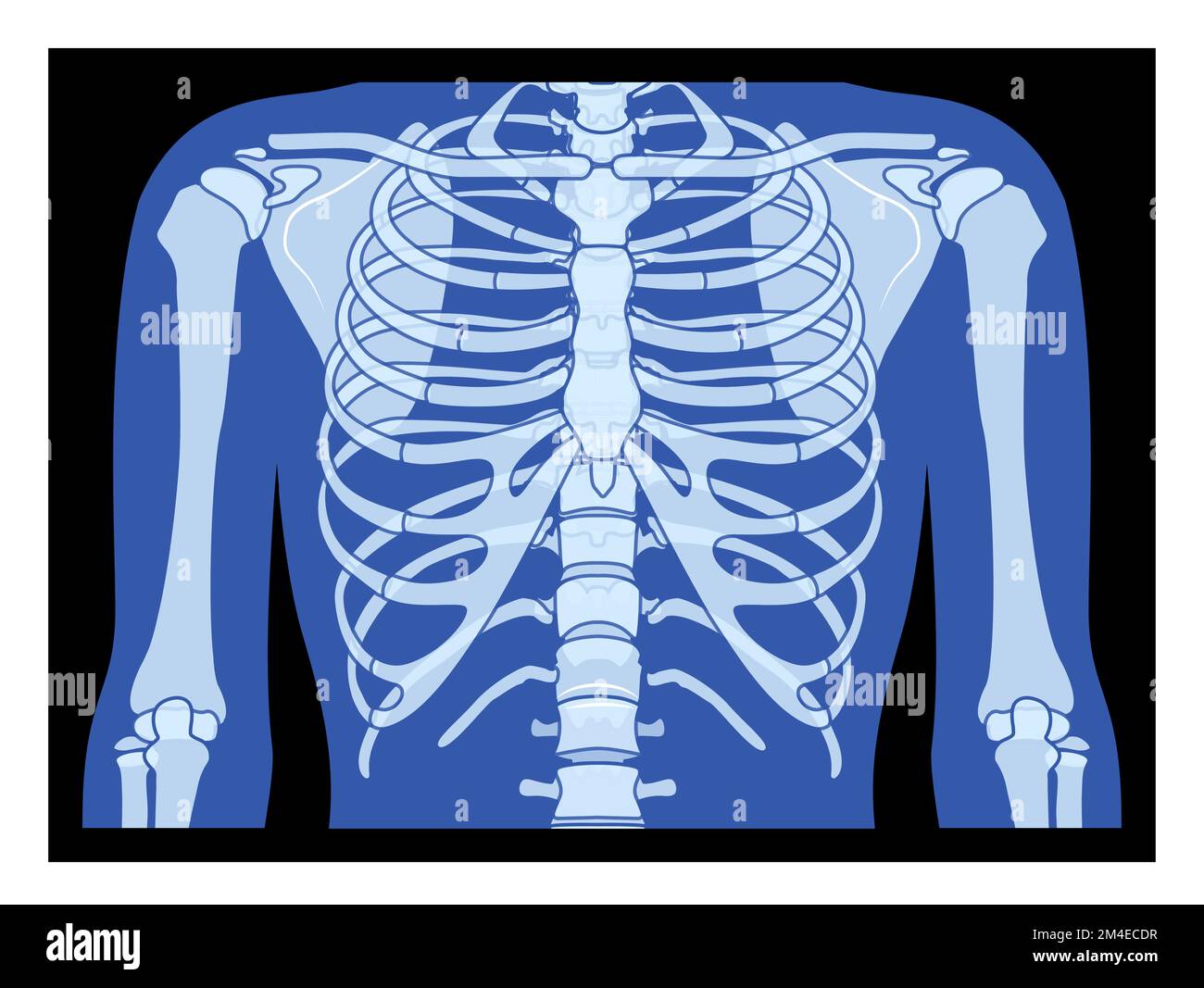 X-Ray rib cage and hands Skeleton Human body Bones adult people roentgen front view. 3D realistic flat blue color concept Vector illustration of medical anatomy isolated on black background Stock Vector