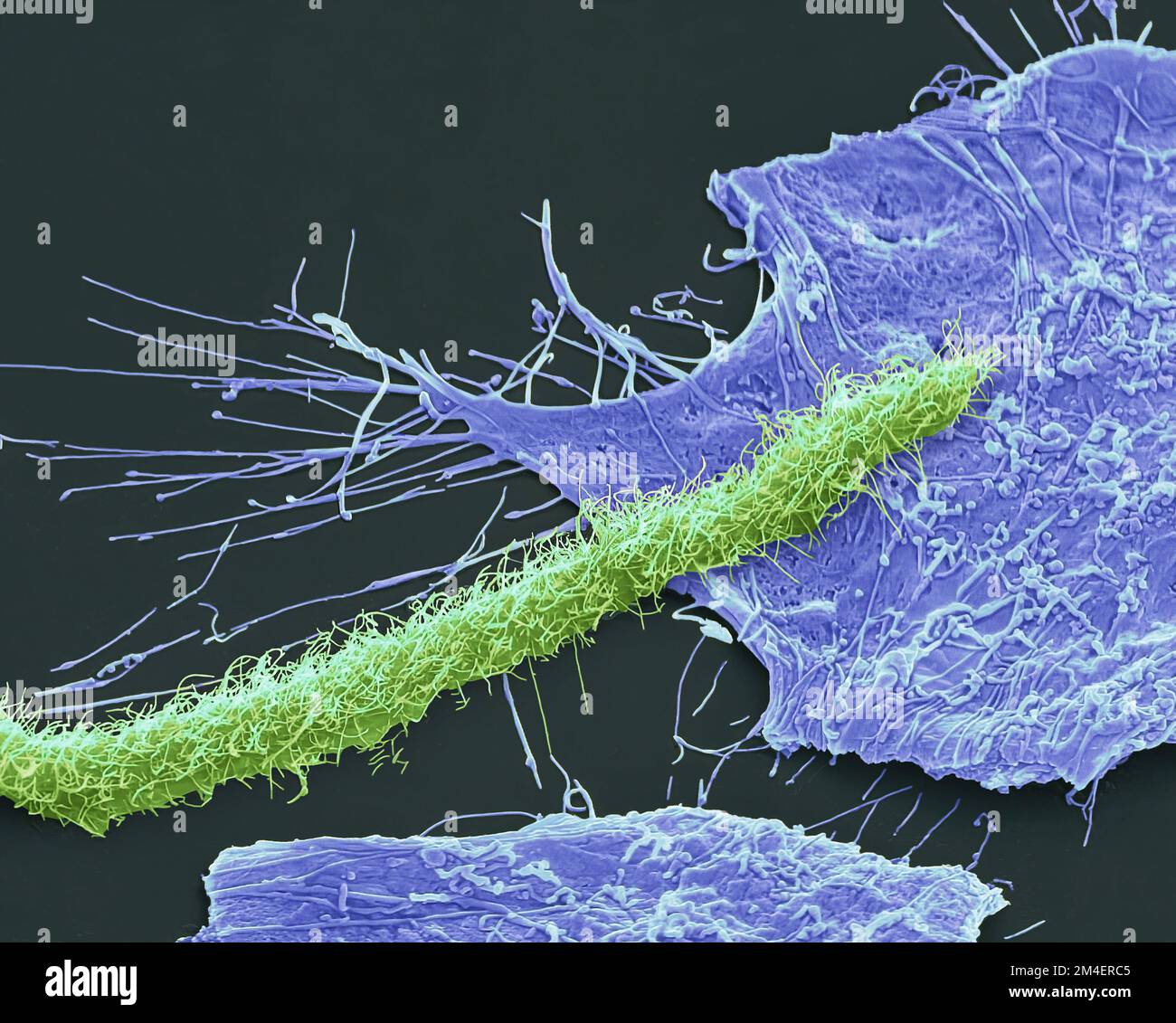 Semga Infection Fungal infection, SEM Stock Photo - Alamy