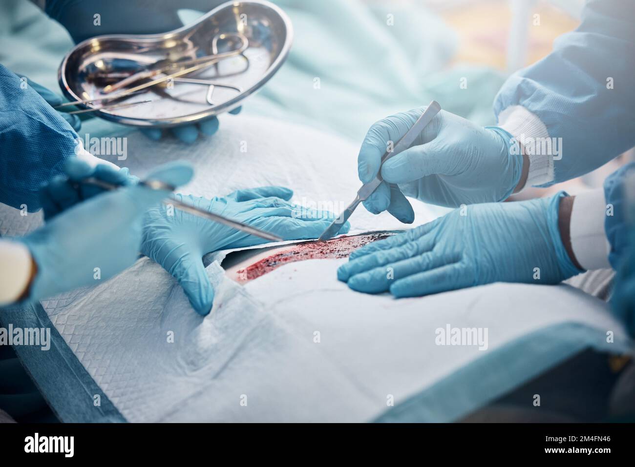 Doctors, nurses or surgery hands on cut patient in hospital emergency room for stomach ulcer, heart attack or burst appendix. Zoom, healthcare workers Stock Photo