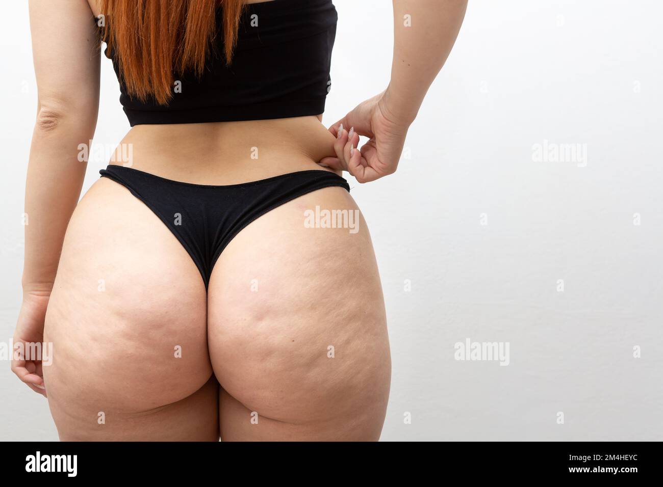 Fat thighs and buttocks hotsell