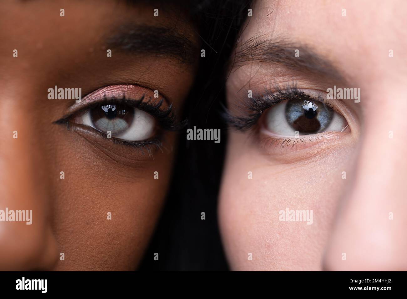 Heterochromia in light eye and dark eye. Caucasian and African complexion with chimeric phenomenon in the eyes with portions of different colors Stock Photo