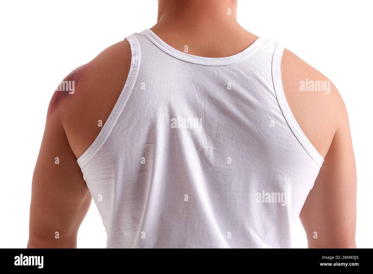 Man with bruise on shoulder against white background Stock Photo