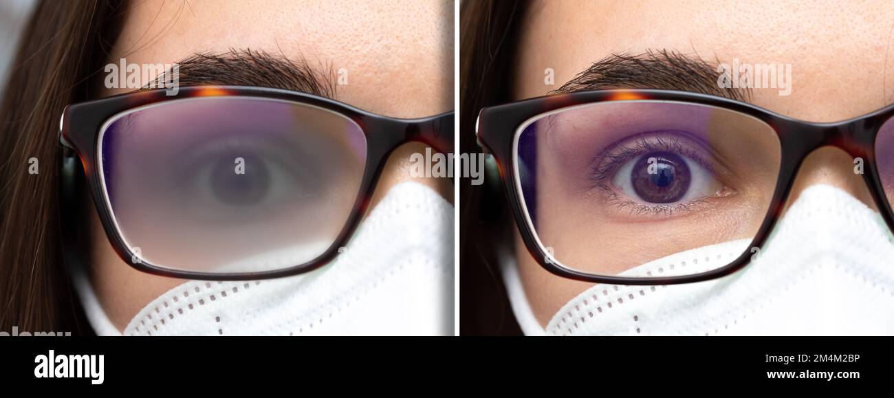 Macro of eye of girl with mask wearing fogged glasses showing the