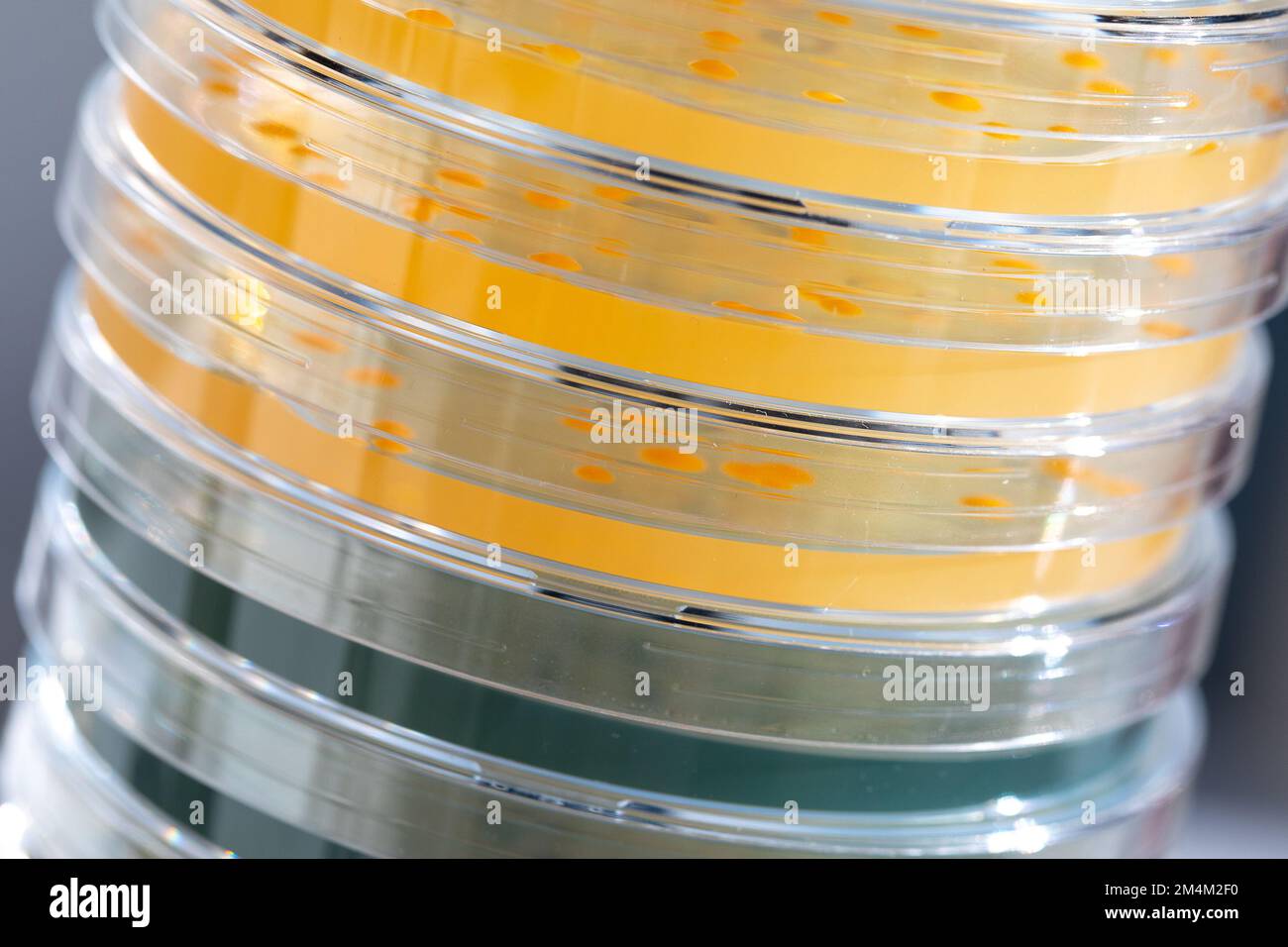Laboratory experiment with close-up of a pile of Petri dishes with cultures of microorganisms to be analyzed. Growth in colored agar medium Stock Photo