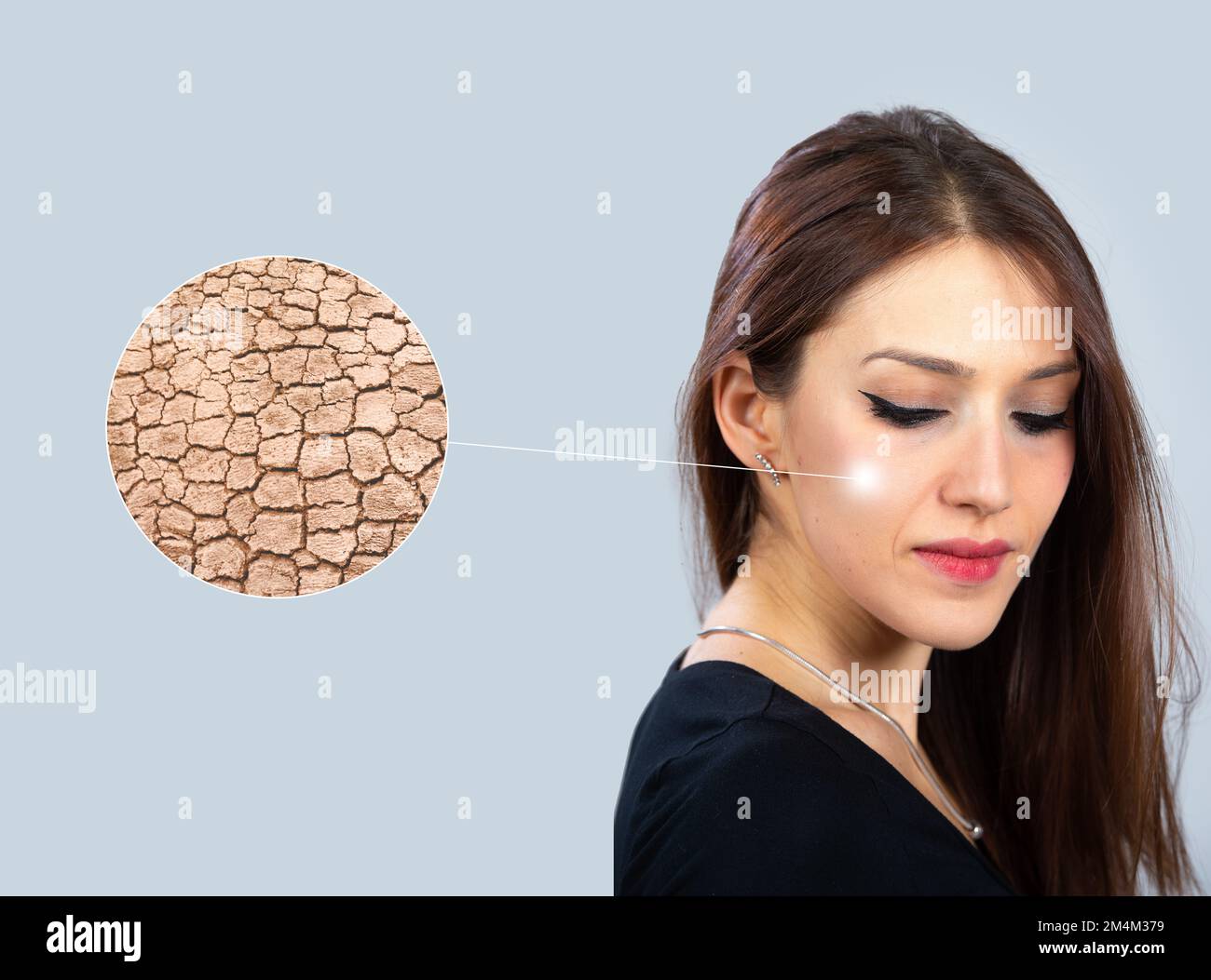Magnified detail of dry, cracked skin on a woman's cheek. Concept of